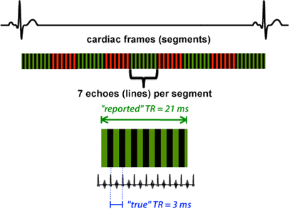 cardiac segments MRI