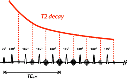 k-space filtering