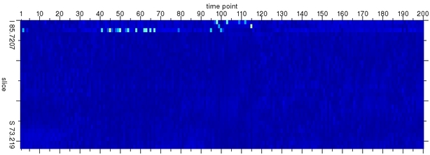 fMRI data spikes