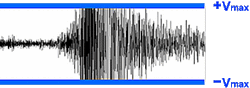 data clipping artifact mri