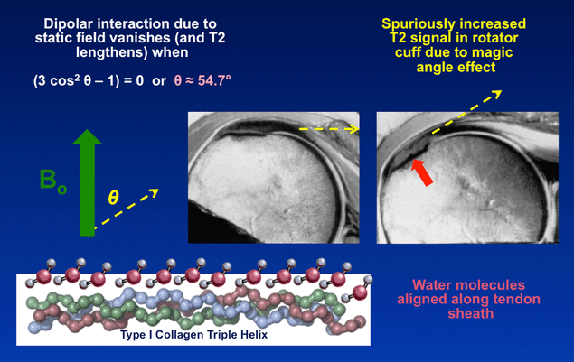 Magic angle NMR MRI