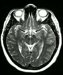 Spin-phase effects MRI