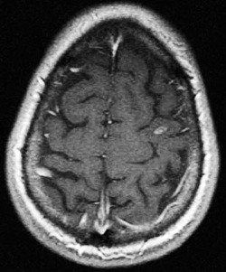 field strength and gadolinium contrast