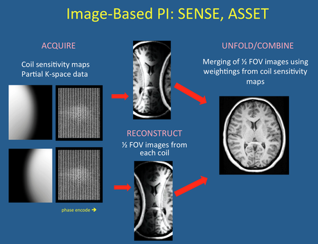 SENSE/ASSET