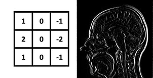 Left-right sobel kernel