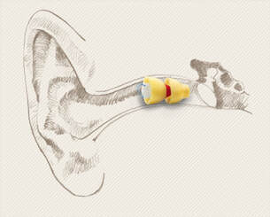 lyric hearing aid