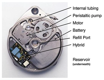 SynchroMed II 